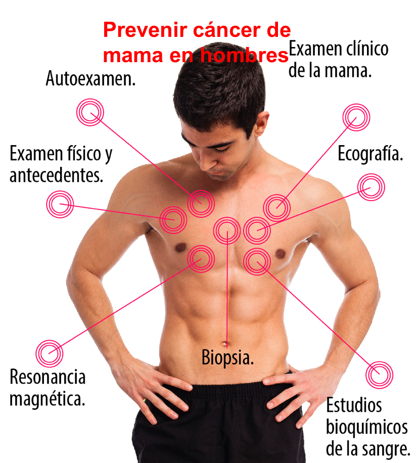 Prevenir cáncer de mama en hombres