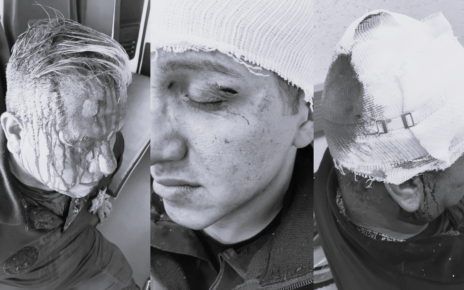 Policías agredidos por estudiantes de Conalep Huixquilucan