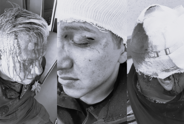 Policías agredidos por estudiantes de Conalep Huixquilucan