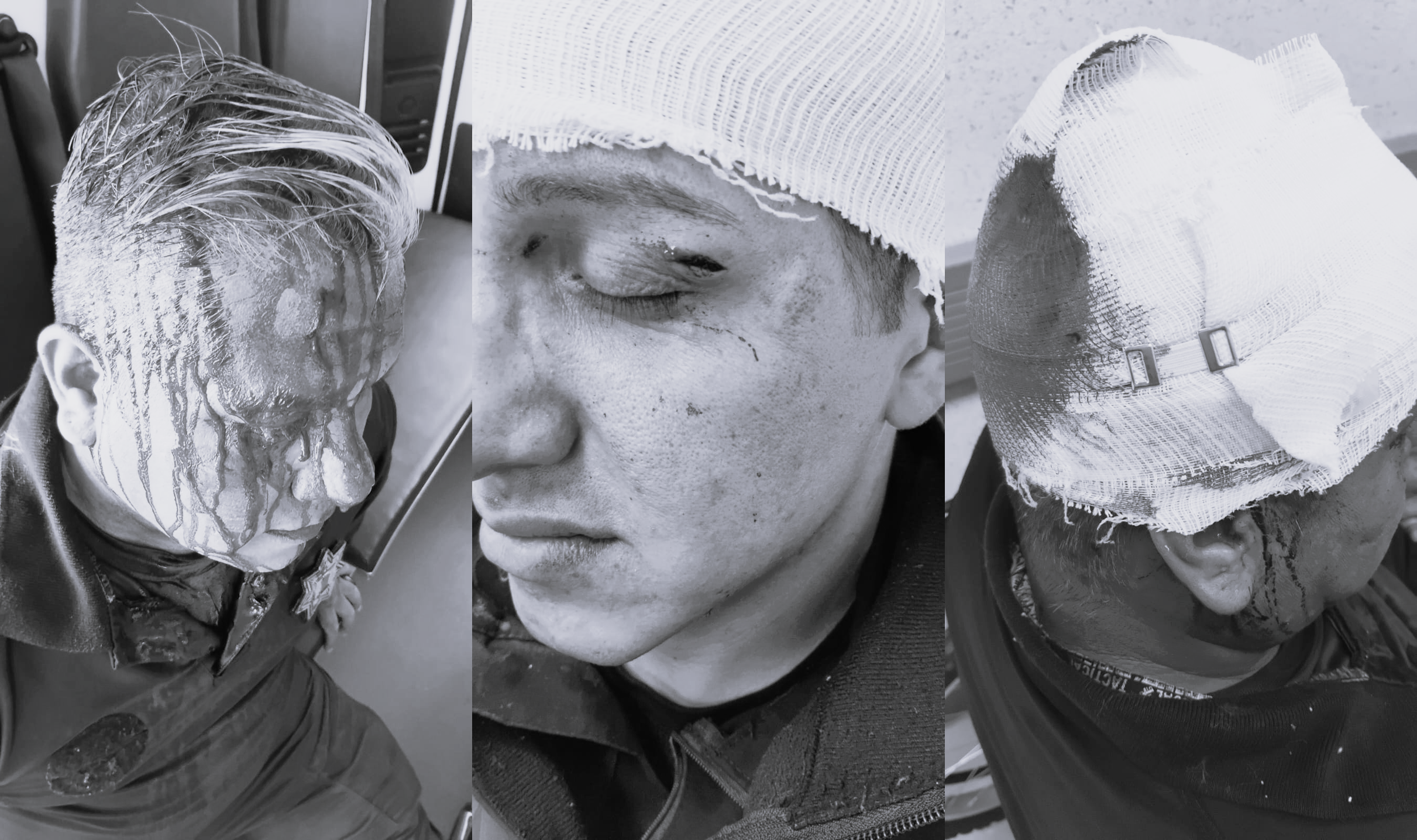 Policías agredidos por estudiantes de Conalep Huixquilucan