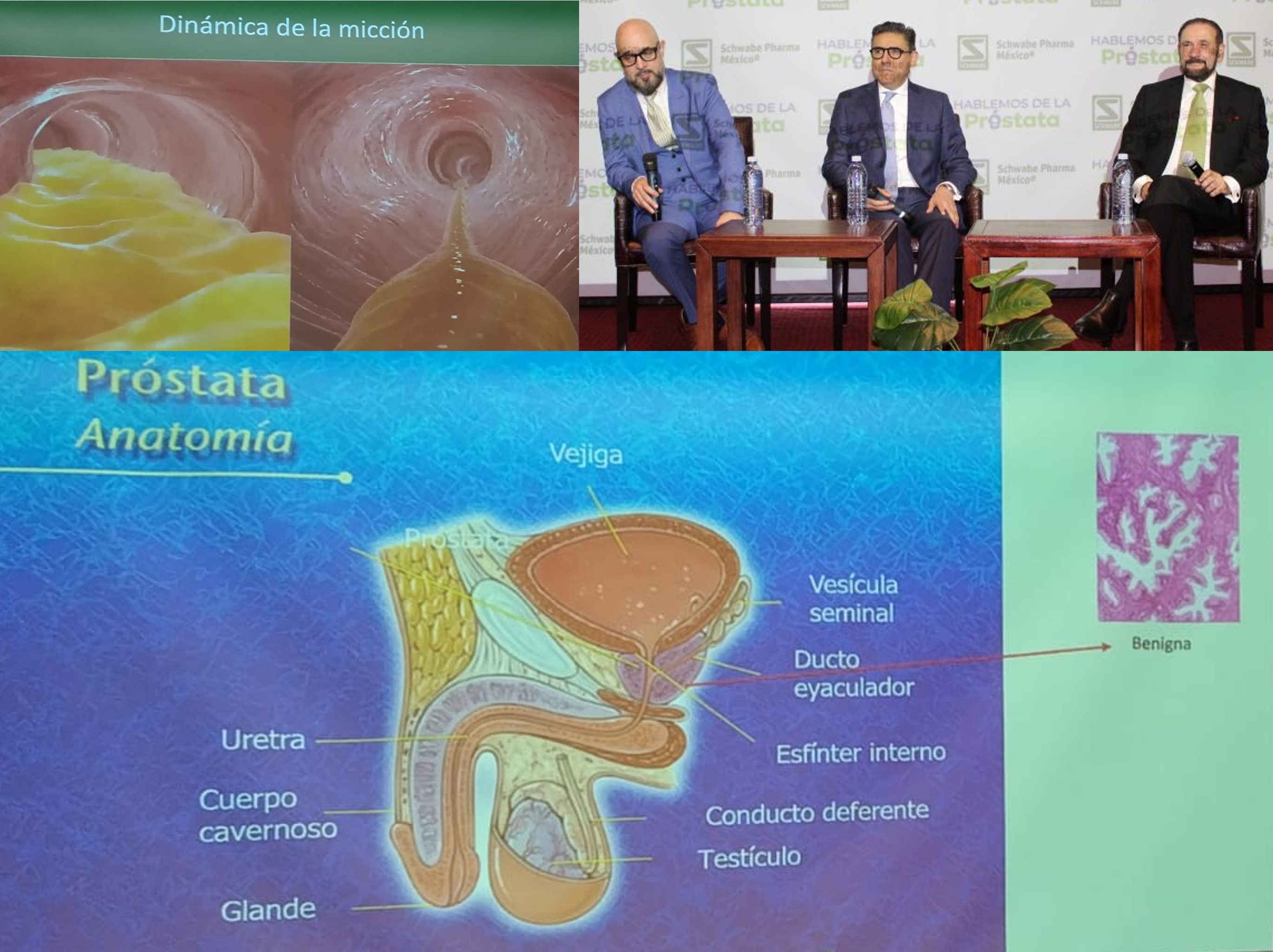Consulta síntomas de dolor en próstata o Síntomas del Tracto Urinario Inferior